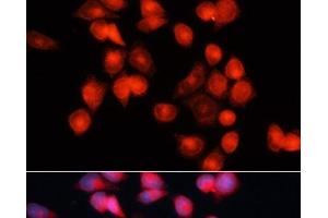 Immunofluorescence analysis of HeLa cells using SLC25A5 Polyclonal Antibody at dilution of 1:100 (40x lens). (SLC25A5 antibody)