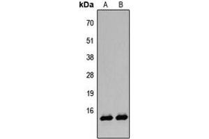 Western blot analysis of Histone H2B (AcK12) expression in A431 TSA-treated (A), HeLa TSA-treated (B) whole cell lysates. (Histone H2B antibody  (acLys12, N-Term))