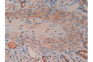 IHC-P analysis of Rat Stomach Tissue, with DAB staining. (SMAD1 antibody  (AA 273-468))
