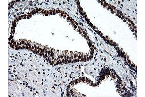 Image no. 1 for anti-EPM2A (Laforin) Interacting Protein 1 (EPM2AIP1) antibody (ABIN1498046) (EPM2AIP1 antibody)