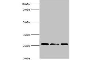 Western blot All lanes: Chloride intracellular channel protein 1 antibody at 4 μg/mL Lane 1: Hela whole cell lysate Lane 2: Jurkat whole cell lysate Lane 3: MCF-7 whole cell lysate Secondary Goat polyclonal to rabbit IgG at 1/10000 dilution Predicted band size: 27 kDa Observed band size: 27 kDa (CLIC1 antibody  (AA 42-241))