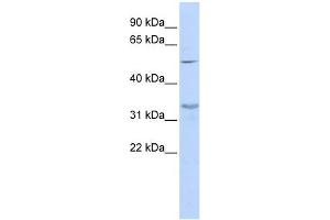 WB Suggested Anti-ZNF765 Antibody Titration:  0. (ZNF765 antibody  (Middle Region))