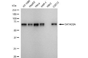 Western blotting analysis using GATAD2A antibody (ABIN7798698).
