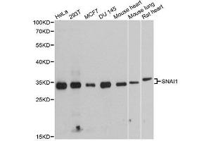 Western blot analysis of extracts of various cell lines, using SNAI1 antibody. (SNAIL antibody  (AA 1-264))