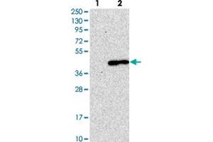 Western blot analysis of Lane 1: Negative control (vector only transfected HEK293T lysate). (LMAN2 antibody)