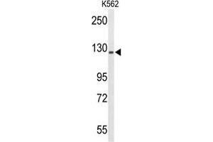 Western blot analysis of TREF1 Antibody (C-term) in K562 cell line lysates (35 µg/lane).