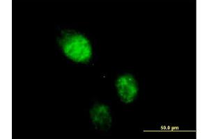 Immunofluorescence of purified MaxPab antibody to RAD23B on HeLa cell. (RAD23B antibody  (AA 1-409))