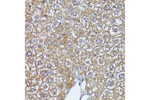 Immunohistochemistry (IHC) image for anti-Aldo-keto Reductase Family 1, Member C2 (AKR1C2) (AA 1-323) antibody (ABIN7265549)