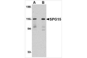 Western blot analysis of SPG15 in rat heart tissue lysate with SPG15 antibody at (A) 0.