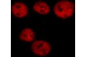 ABIN6267273 staining HeLa cells by ICC/IF.