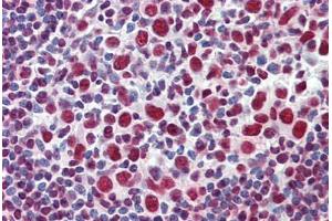Human Tonsil: Formalin-Fixed, Paraffin-Embedded (FFPE) (GRB2 antibody  (AA 156-217))