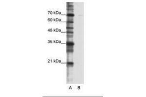 Image no. 1 for anti-Cleavage Stimulation Factor, 3' Pre-RNA, Subunit 2, 64kDa, tau Variant (CSTF2T) (AA 521-570) antibody (ABIN6736229) (CSTF2T antibody  (AA 521-570))