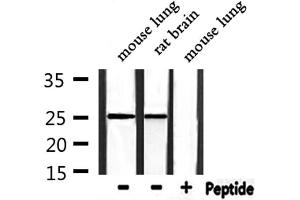 Western blot analysis of extracts from mouse lung, rat brain, using RIT1 Antibody. (RIT1 antibody  (C-Term))