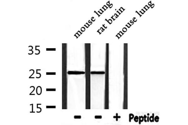 RIT1 antibody  (C-Term)