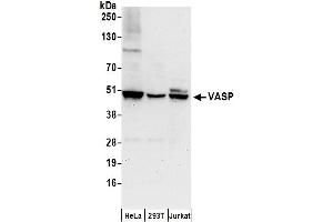 Western Blotting (WB) image for anti-Vasodilator-Stimulated phosphoprotein (VASP) (AA 330-380) antibody (ABIN7449856)