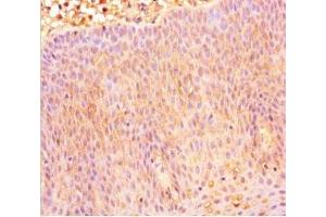Immunohistochemistry of paraffin-embedded human tonsil tissue using ABIN7146107 at dilution of 1:100 (CXCR4 antibody  (AA 1-356))