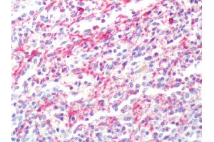 Human Spleen: Formalin-Fixed, Paraffin-Embedded (FFPE) (CXCR2 antibody  (Extracellular Domain))