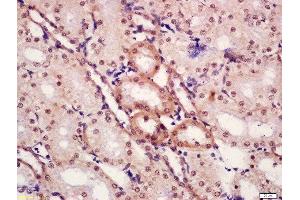 Formalin-fixed and paraffin embedded rat kidney tissue labeled with Anti-CTBP1 (Ser422) Polyclonal Antibody, Unconjugated  at 1:300 followed by conjugation to the secondary antibody and DAB staining. (CTBP1 antibody  (pSer422))
