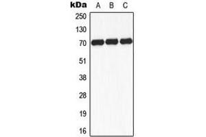 Western blot analysis of S6K1 (pS434) expression in K562 insulin-treated (A), mouse brain (B), rat brain (C) whole cell lysates. (RPS6KB1 antibody  (C-Term, pSer434))