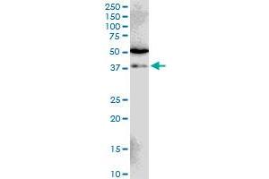 SIAH1 Antikörper  (AA 1-110)
