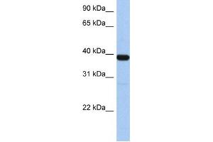 Western Blotting (WB) image for anti-Zinc Finger Protein 781 (ZNF781) antibody (ABIN2459447)