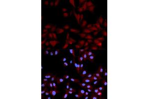 Immunofluorescence (IF) image for anti-Mitogen-Activated Protein Kinase 14 (MAPK14) (pTyr182) antibody (ABIN1870378) (MAPK14 antibody  (pTyr182))