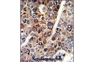Immunohistochemistry (Paraffin-embedded Sections) (IHC (p)) image for anti-CD38 (AA 241-270), (C-Term) antibody (ABIN389405)