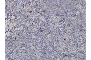Immunoperoxidase of monoclonal antibody to NKIRAS2 on formalin-fixed paraffin-embedded human tonsil. (NKIRAS2 antibody  (AA 1-191))