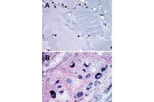 Bi-1 Immunohistochemistry. (Bax Inhibitor 1 antibody)