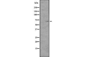 Western blot analysis of TCHP expression in CEM cell lysate ,The lane on the left is treated with the antigen-specific peptide. (TCHP antibody  (C-Term))