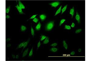 Immunofluorescence of monoclonal antibody to TESK2 on HeLa cell. (TESK2 antibody  (AA 405-542))