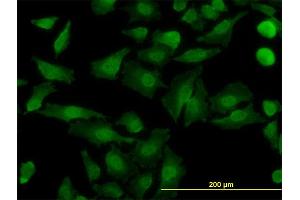 Immunofluorescence of monoclonal antibody to NDE1 on HeLa cell. (NDE1 antibody  (AA 1-335))