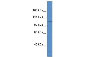 Western Blot showing FAM120C antibody used at a concentration of 1 ug/ml against Jurkat Cell Lysate (FAM120C antibody  (N-Term))