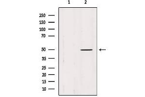 Western blot analysis of extracts from Mouse brain, using IFT52 Antibody. (IFT52 antibody  (Internal Region))