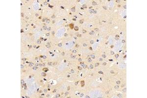 Immunohistochemistry analysis of paraffin-embedded mouse lung using,MFAP4 (ABIN7074614) at dilution of 1: 2000 (MFAP4 antibody)