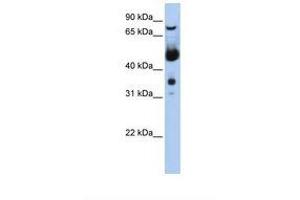 Image no. 1 for anti-Menage A Trois Homolog 1, Cyclin H Assembly Factor (Xenopus Laevis) (MNAT1) (N-Term) antibody (ABIN6739103) (MNAT1 antibody  (N-Term))