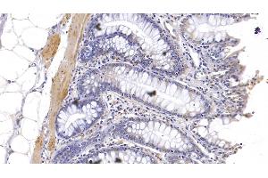 Detection of KPNa3 in Human Colon Tissue using Polyclonal Antibody to Karyopherin Alpha 3 (KPNa3) (KPNA3 antibody  (AA 3-220))