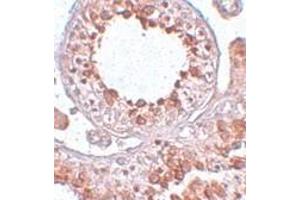 Immunohistochemistry of ESX1 in human testis tissue with ESX1 antibody at 2. (ESX Homeobox 1 antibody  (Center))