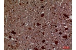 Immunohistochemistry (IHC) analysis of paraffin-embedded Rat Brain, antibody was diluted at 1:100. (Hexosaminidase A antibody  (Internal Region))
