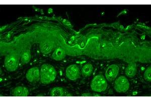 Ubiquitin, Mouse backskin. (Ubiquitin antibody)