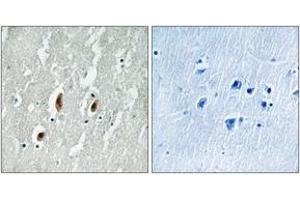 Immunohistochemistry analysis of paraffin-embedded human brain tissue, using SRF (Ab-77) Antibody. (SRF antibody  (AA 41-90))