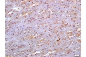 Formalin-fixed and paraffin embedded mouse stomach labeled with Anti-SDF4 Polyclonal Antibody, Unconjugated (ABIN720595) at 1:200 followed by conjugation to the secondary antibody and DAB staining (SDF4 antibody  (AA 121-230))