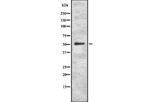 Western blot analysis of CAP2 using K562 whole cell lysates