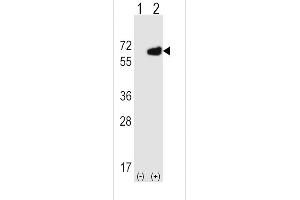 Western blot analysis of NT5E using rabbit polyclonal NT5E Antibody (M535) using 293 cell lysates (2 ug/lane) either nontransfected (Lane 1) or transiently transfected (Lane 2) with the NT5E gene. (CD73 antibody  (C-Term))