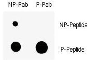 Dot blot analysis of nonphos (NP) and phospho-Wee1 antibody (P). (WEE1 antibody  (pSer123))
