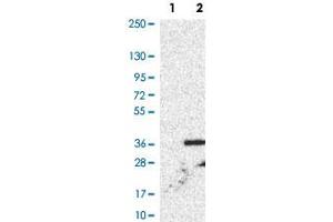 Western Blot analysis of Lane 1: negative control (vector only transfected HEK293T cell lysate) and Lane 2: over-expression lysate (co-expressed with a C-terminal myc-DDK tag in mammalian HEK293T cells) with XCR1 polyclonal antibody . (XCR1 antibody)