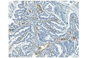 IHC analysis of CD146/MCAM using anti-CD146/MCAM antibody (ABIN7602098). (MCAM antibody  (AA 59-401))