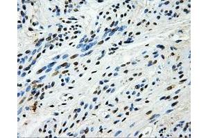 Immunohistochemical staining of paraffin-embedded endometrium tissue using anti-HK2mouse monoclonal antibody. (Hexokinase 2 antibody)