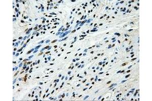 Immunohistochemical staining of paraffin-embedded endometrium tissue using anti-HK2mouse monoclonal antibody.