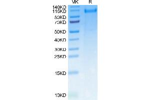 Rat CDCP1 on Tris-Bis PAGE under reduced condition. (CDCP1 Protein (AA 29-666) (His tag))